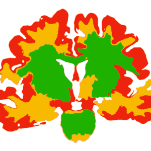brain colonal